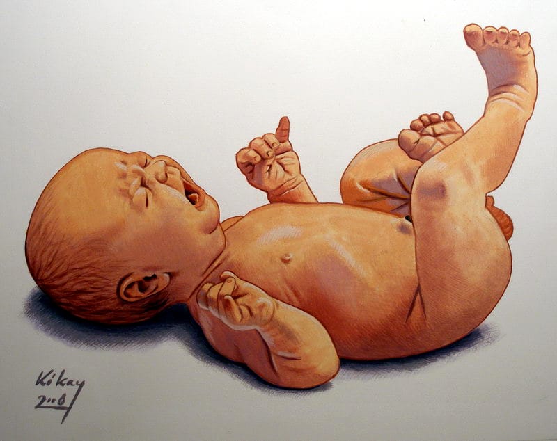 Birth