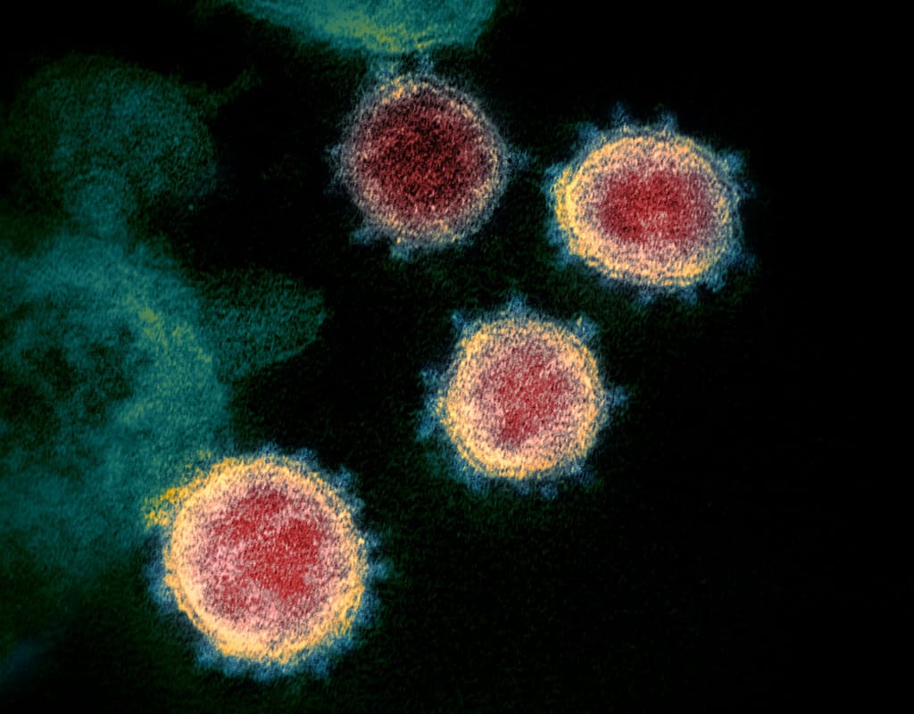 COVID-19 Pandemic