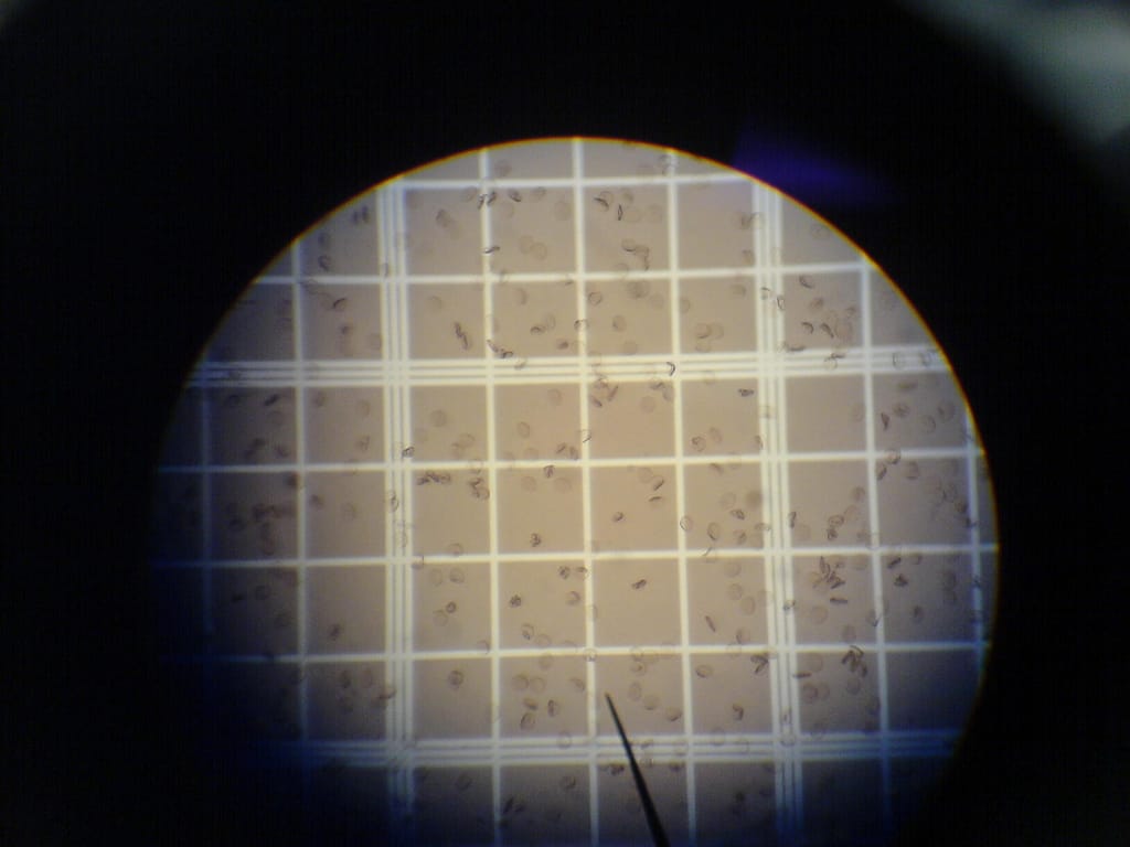 Red Blood Cell