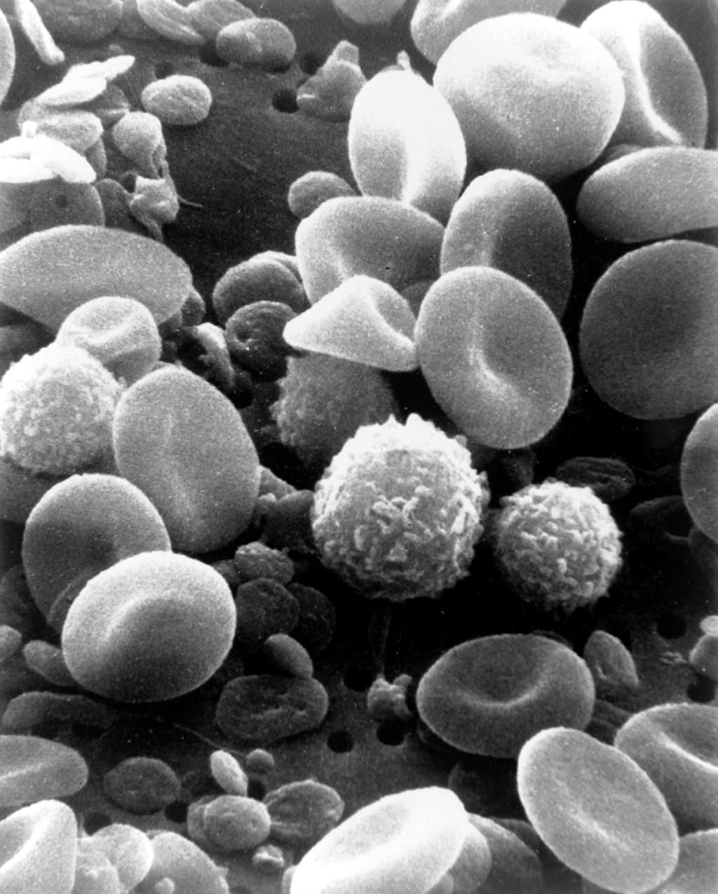 White Blood Cell
